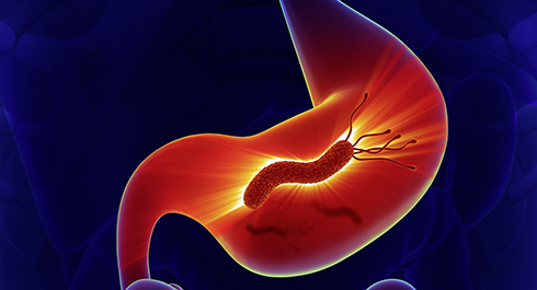 La bactérie Helicobacter pylori 